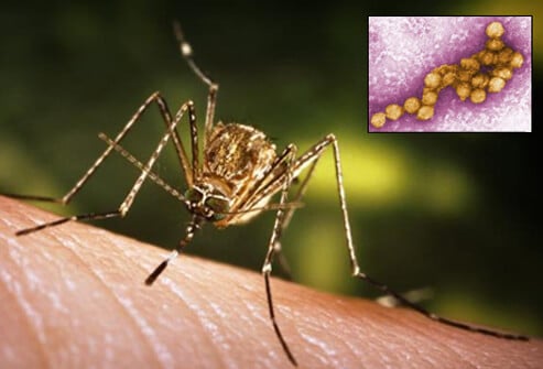 Chem Pest Service, Pest Control company in Newark Pest Control Services by Chem Pest Service in Newark, Texas